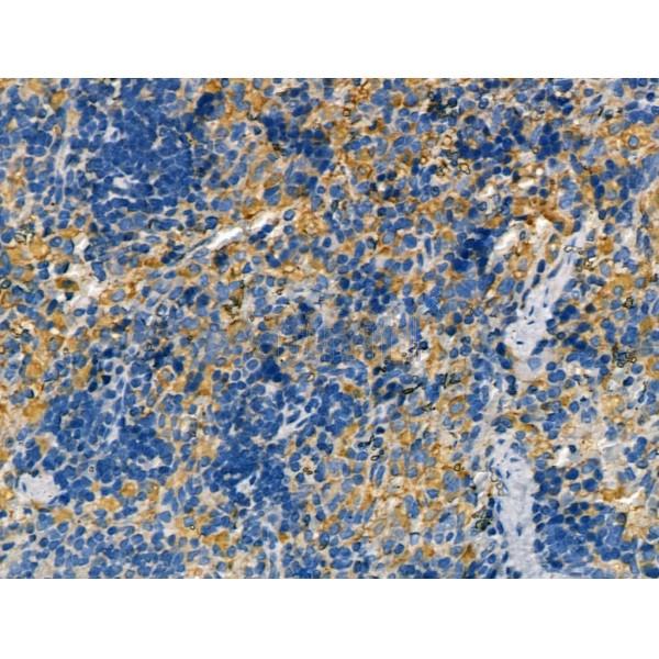 Nicotinic Acetylcholine Receptor alpha 7 Antibody -DF13247