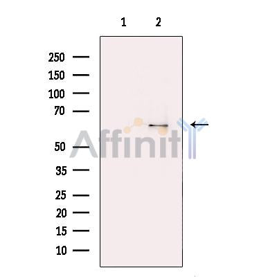 RPE65 Antibody -DF13248
