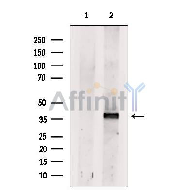 Dectin-1 Antibody -DF13249