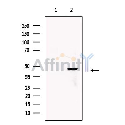 LOX Antibody -DF13251