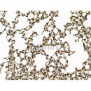 Blooms Syndrome Protein Blm Antibody -DF13252