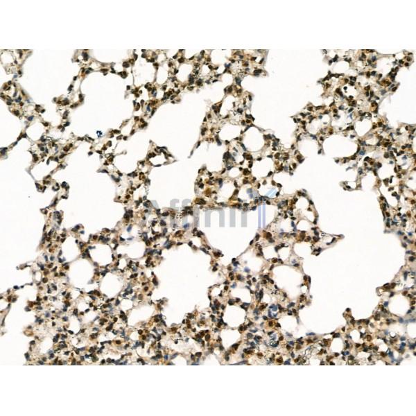 Blooms Syndrome Protein Blm Antibody -DF13252