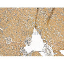 SCD1 Antibody -DF13253