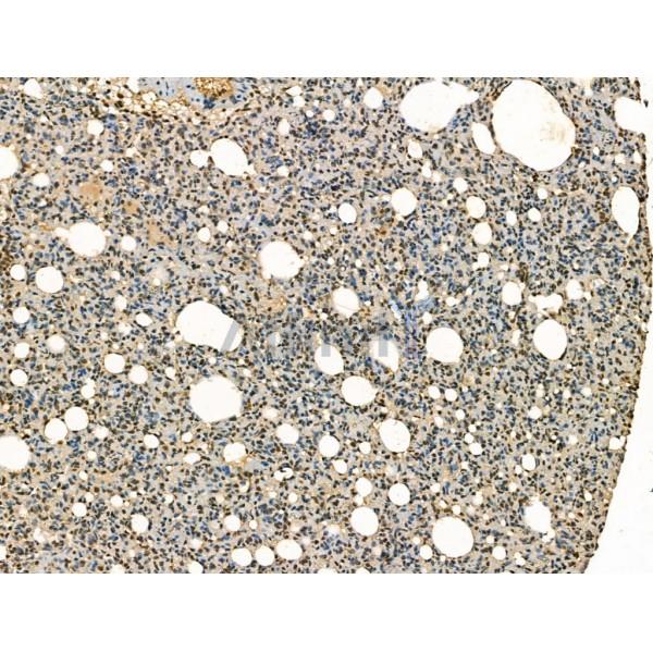 Proteasome 20S LMP7 Antibody -DF13259