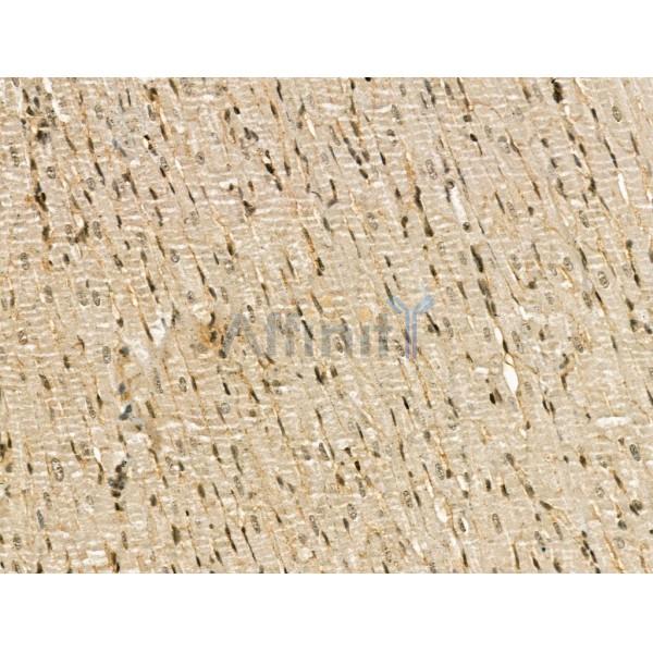 CENPB Antibody -DF13261