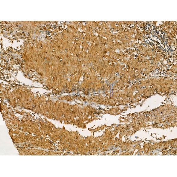 CD36 Antibody -DF13262