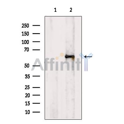 Retinoid X Receptor beta Antibody -DF13265