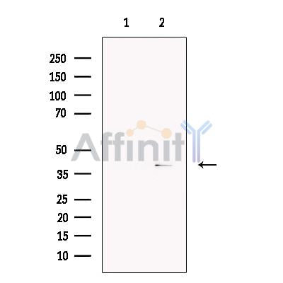 VPS26 Antibody -DF13267