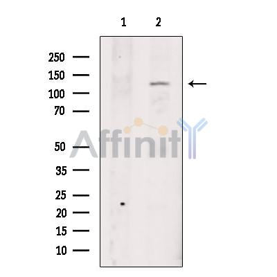 TRPA1 Antibody -DF13269