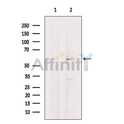 SNTB2 Antibody -DF13272