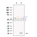 PBR Antibody -DF13279