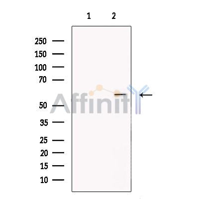 Syntrophin alpha 1 Antibody -DF13280