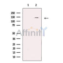 KMT1E / SETDB1 Antibody -DF13289