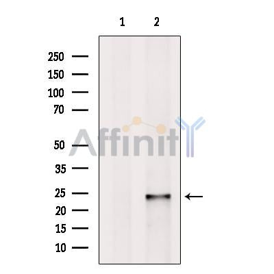 Rab4 Antibody -DF13290