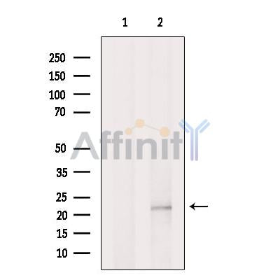 SCXA Antibody -DF13293
