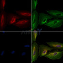 CD62P Antibody -DF13294