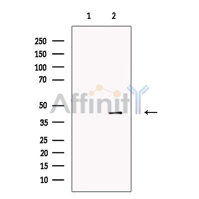 P2X3 Antibody -DF13297