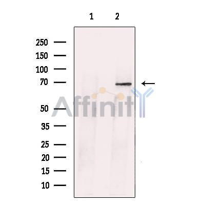 Bestrophin Antibody -DF13298