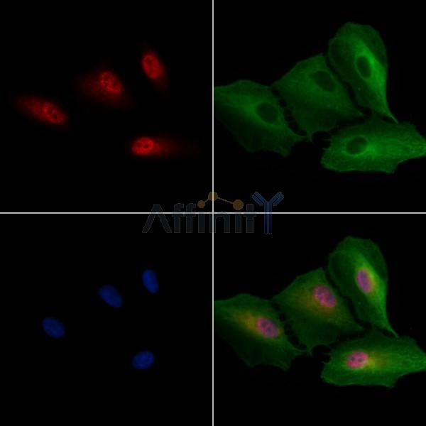 macroH2A.1 Antibody -DF13300