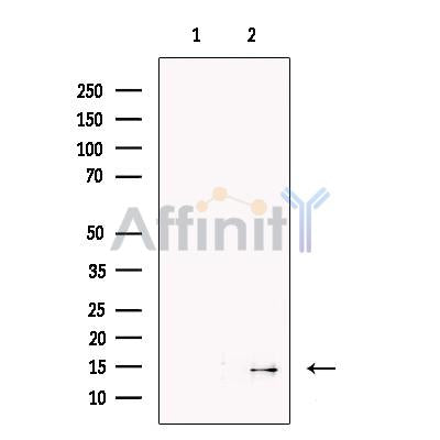Serum Amyloid A Antibody -DF13301