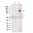 Mineralocorticoid Receptor Antibody -DF13302
