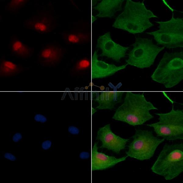 FKBP51 Antibody -DF13305