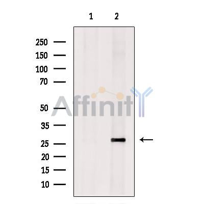 Kallikrein 9 Antibody -DF13306