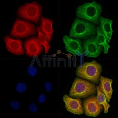 GDNF Receptor alpha 2 Antibody -DF13307