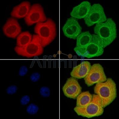 BAFF Antibody -DF13308