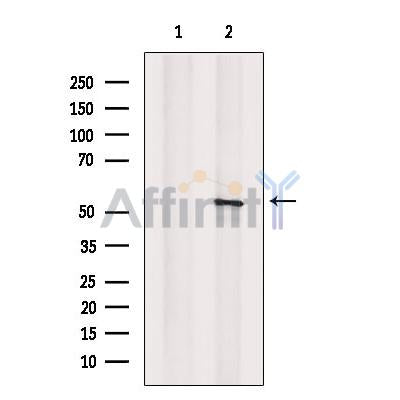 KAT8 Antibody -DF13309