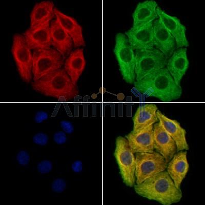 CAP1 Antibody -DF13310