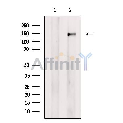 SMC2 Antibody -DF13315