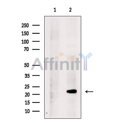 Ribosomal protein L26 Antibody -DF13322