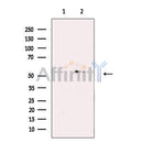 5HT7 Receptor Antibody -DF13323