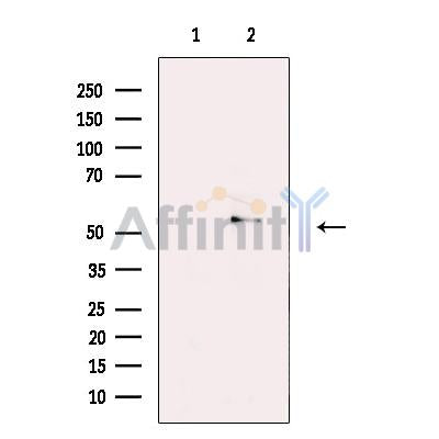 5HT7 Receptor Antibody -DF13323
