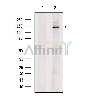 Calcium Pump PMCA4 ATPase Antibody -DF13326