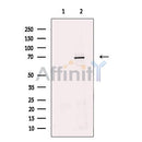Prolactin Receptor Antibody -DF13327