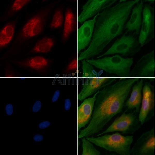 GFR alpha 3 Antibody -DF13329