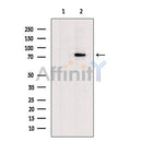 Glutaminase Antibody -DF13334