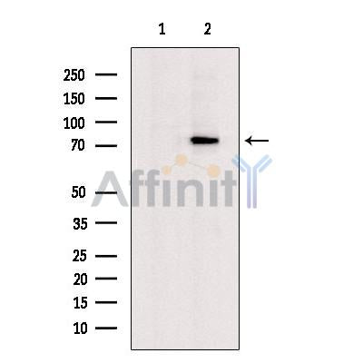 Glutaminase Antibody -DF13334