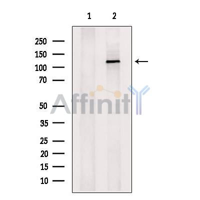 KDM4A Antibody -DF13340