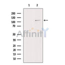PHF8 Antibody -DF13341
