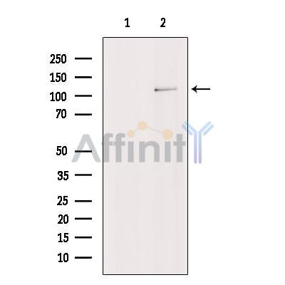 PHF8 Antibody -DF13341