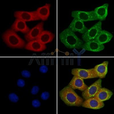 GABA A Receptor alpha 5 Antibody -DF13345