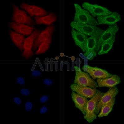 MSH4 Antibody -DF13354