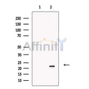 SLC31A1 / CTR1 Antibody -DF13356