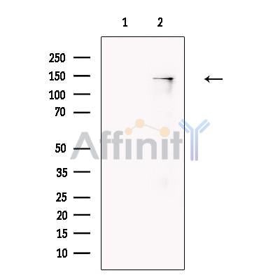 Endostatin Antibody -DF13358