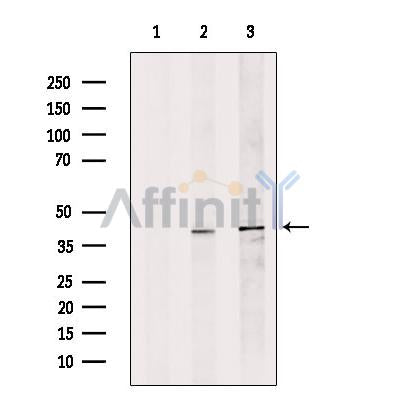 DFFB Antibody -DF13360