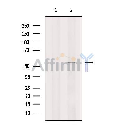 DGAT1 Antibody -DF13368