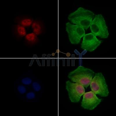 CBX1 / HP1 beta Antibody -DF13369